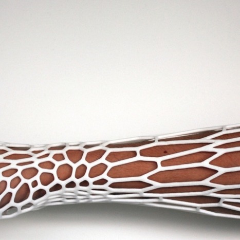 A New Way to Heal Broken Bones: 3D-Printed Casts | 21st Century Innovative Technologies and Developments as also discoveries, curiosity ( insolite)... | Scoop.it
