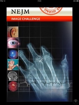 Test your diagnostic skills with the NEJM Image Challenge app | Immunology Diagnosis | Scoop.it