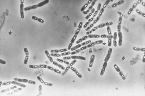Biopesticides bact&eacute;riens : une d&eacute;couverte pour produire des toxines insecticides sans formation de spores | Innovation Agro-activit&eacute;s et Bio-industries | Scoop.it