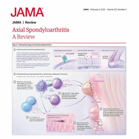JAMA on LinkedIn: This narrative review summarizes current evidence on the pathogenesis… | Rheumatology-Rhumatologie | Scoop.it