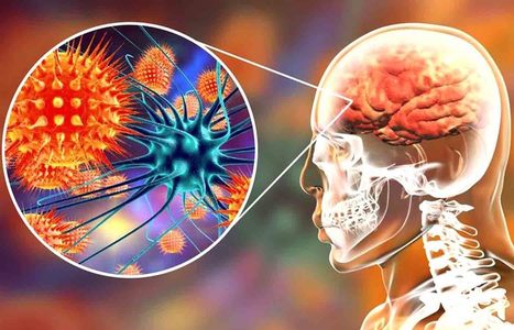 Functional Neurology: Understanding Autoimmune Brain Disease | El Paso, TX Chiropractor | Call: 915-850-0900 | Neuropathy "The Painful Enigma" | Scoop.it