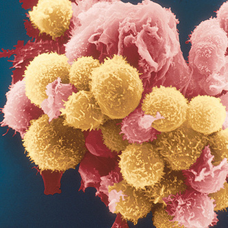 New Hope for Cancer Treatment - MIT Technology Review | 21st Century Innovative Technologies and Developments as also discoveries, curiosity ( insolite)... | Scoop.it