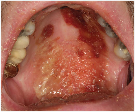 Common Oral Conditions: A Review | Dental Medicine | JAMA | JAMA Network | Comprehensive Geriatric Assessment | Scoop.it
