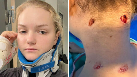 Svenska Naemi, 21, biten i nacken av lejon på safari i Sydafrika | 1Uutiset - Lukemisen tähden | Scoop.it