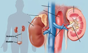 Kidney failure is NOT the end of life | Peritoneal dialysis | Scoop.it