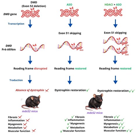 Dystrophie musculaire de Duchenne : combiner deux th&eacute;rapies pour am&eacute;liorer la restauration de la dystrophine | Life Sciences Universit&eacute; Paris-Saclay | Scoop.it