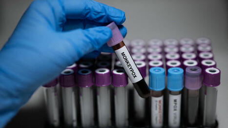 Epidémie de mpox : pas d'élargissement de la vaccination en France mais un rappel recommandé pour certaines personnes à risques | sida | Scoop.it
