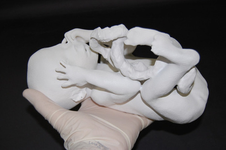 New Scientist TV: 3D fetus fly-through peers inside abnormal bodies | Amazing Science | Scoop.it