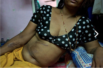 The Burned and Bloodied Sex Workers of South Mumbai | For Art's Sake-1 | Scoop.it