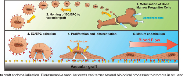 Better Endothelization Looking Forward to a Clinical Impact | Neurovascular Intervention | Scoop.it