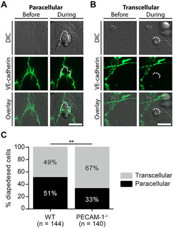 PECAM-1 Stabilizes Blood-Brain Barrier Integrity and Favors Paracellular T-Cell Diapedesis Across the Blood-Brain Barrier During Neuroinflammation | Neurovascular Intervention | Scoop.it