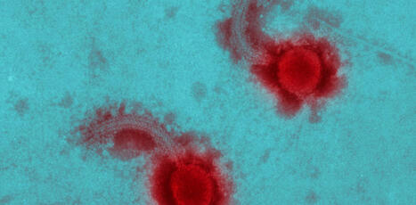 Demain, des virus au service de la médecine pour traiter des cancers, comme alternatives aux antibiotiques notamment (The Conversation) | GRIEPS | Scoop.it