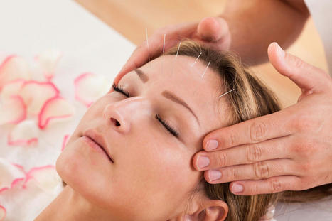 Reducing Headaches With Acupuncture: All You Need to Know | Call: 915-850-0900 | Chiropractic + Wellness | Scoop.it