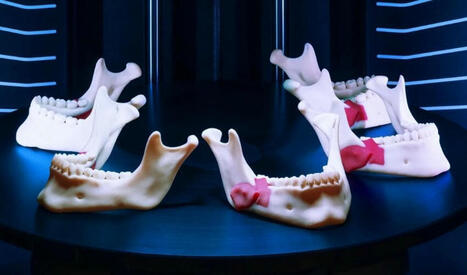 Planification chirurgicale et impression 3D : où en sommes-nous ? | Buzz e-sante | Scoop.it