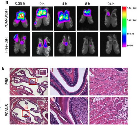 Toward a Radically Simple Multi-Modal Nasal Spray for Preventing Respiratory Infections | Virus World | Scoop.it