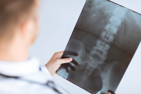 Spinal Injuries: Diagnosis and Treatment after an Accident in Florida | Personal Injury Attorney News | Scoop.it