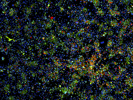 A step closer to artificial livers | KurzweilAI | Longevity science | Scoop.it