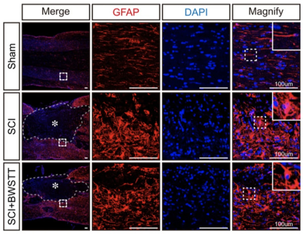 Body weight-supported treadmill training reduces glial scar overgrowth in SCI rats by decreasing the reactivity of astrocytes during the subacute phase  | Brain Computer Interfaces & connected medical devices | Scoop.it