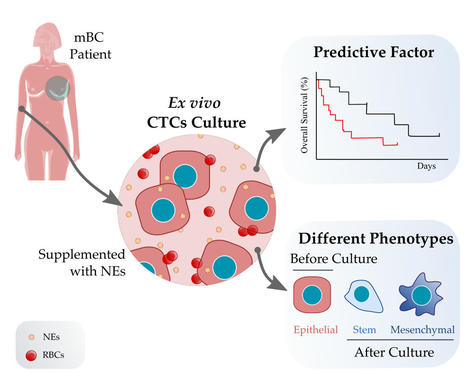 Short-Term Ex Vivo Culture of CTCs From Advance Breast Cancer Patients: Clinical Implications[v1] | Preprints | from Flow Cytometry to Cytomics | Scoop.it