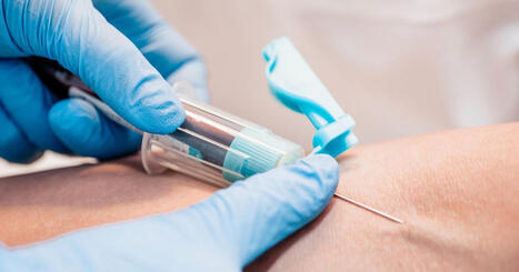 As Consumers Take Testing Into Their Own Hands, Clinical Labs Looks to Cash In | Laboratory Medicine | Scoop.it