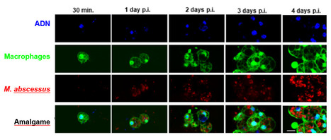 Compréhension des étapes précoces de l’infection à Mycobacterium abscessus grâce à la drosophile | Life Sciences Université Paris-Saclay | Scoop.it