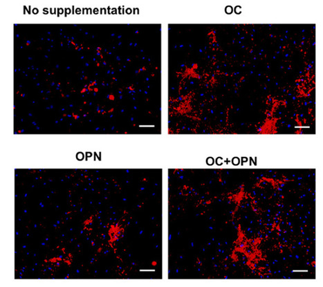 Synergistic Effect of Osteopontin and Osteocalcin on Stem Cell Properties | iBB | Scoop.it