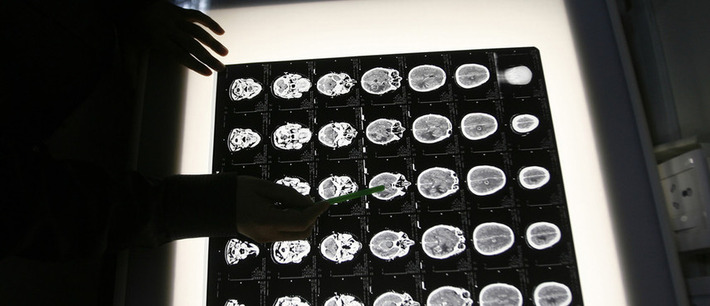 What trying to suppress unwanted memories does to your brain | The Health Report | Scoop.it