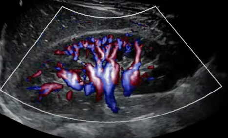 Mindray Debuts Resona A20 Premium Ultrasound Device at RSNA | Diagnostic Imaging | Health Device News | Scoop.it