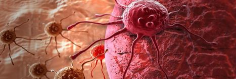 Dieser neue Wirkstoff stoppt die Ausbreitung von Hautkrebs | #Research #Cancer | 21st Century Innovative Technologies and Developments as also discoveries, curiosity ( insolite)... | Scoop.it