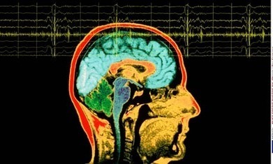 The brain… it makes you think. Doesn't it? | Science News | Scoop.it