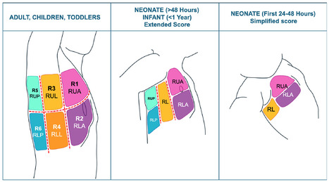 Recommandations Européennes sur l’échographie pulmonaire quantitative en réanimation adulte-enfant-nouveau-né | Life Sciences Université Paris-Saclay | Scoop.it