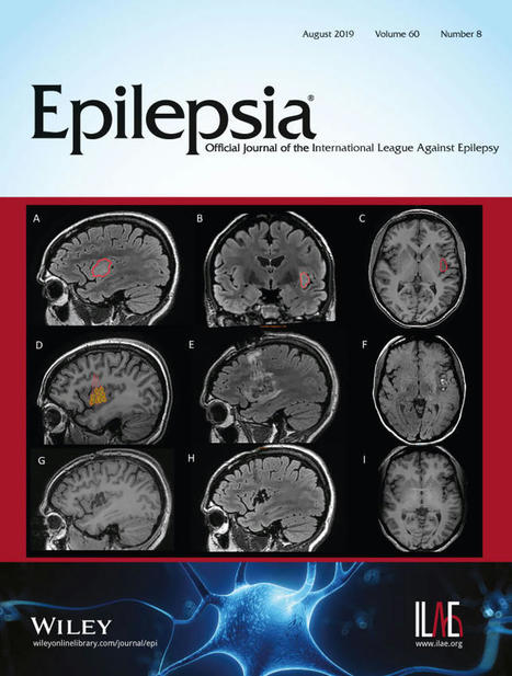 Seizure specificities in patients with antibody‐mediated autoimmune encephalitis - Vogrig - 2019 - Epilepsia | AntiNMDA | Scoop.it