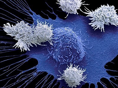 Cancer-fighting immune cells could soon be engineered inside our bodies - Nature | Genetic Engineering Publications - GEG Tech top picks | Scoop.it