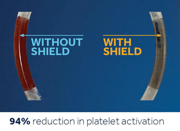 Master & Fellow - Pipeline™ Vantage with Shield Technology™ for intracranial aneurysms by MEDTRONIC | Transcatheter Treatment of Mitral Regurgitation | Scoop.it