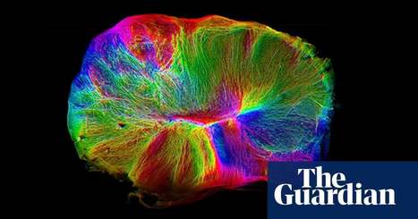 Scientists grow 'mini-brain on the move' that can contract muscle | Science | The Guardian | IELTS, ESP, EAP and CALL | Scoop.it