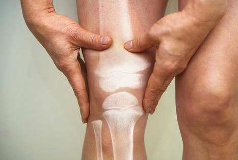 Une technologie 3D pourrait révolutionner le traitement de l’arthrose du genou - Ça m'intéresse | Actualité sanitaire et sociale - CRDI Croix-Rouge Compétence                               Hauts-de-France | Scoop.it