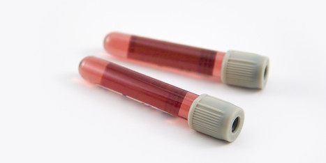 Bient&ocirc;t des m&eacute;dicaments pour gu&eacute;rir &agrave; 100% de l'h&eacute;patite C | Microbiologie | Scoop.it