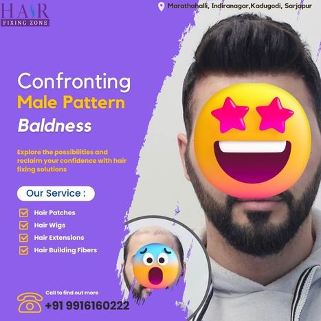 Confronting Male Pattern Baldness Head-On | hair fixing in bangalore | Scoop.it