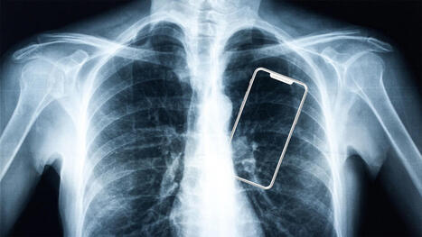 Como seu smartphone est&aacute; mudando seu corpo | Inova&ccedil;&atilde;o Educacional | Scoop.it