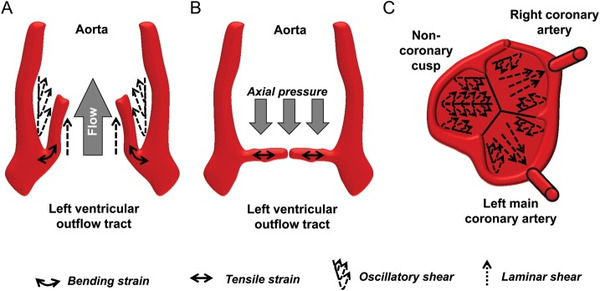 Biomechanical factors in the biology of aortic wall and aortic valve diseases | Transcatheter Treatment of Mitral Regurgitation | Scoop.it