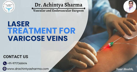Recovery and Aftercare Tips Following Laser Treatment for Varicose Veins | Dr. Achintya Sharma - Vascular and Endovascular Surgeon | Scoop.it