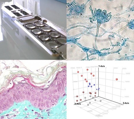 FOCUS PLATEFORME - Du d&eacute;veloppement technologique d&rsquo;une puce d&eacute;di&eacute;e &agrave; l&rsquo;exploration du transcriptome d&rsquo;un champignon, &agrave; un contrat industriel : retour sur une success story | Life Sciences Universit&eacute; Paris-Saclay | Scoop.it