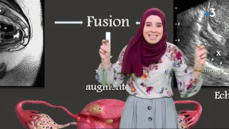 [INP-IRIT] Endométriose : améliorer le diagnostic, avec Oumaima El Mansouri | Exploreur | InMédias | Scoop.it