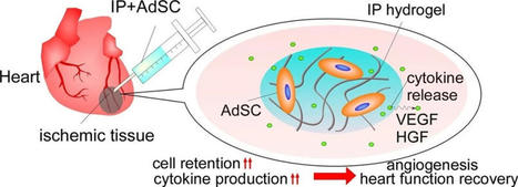 New stem-cell-carrying hydrogel could help the heart recover from myocardial ischemia | Tailored Expertise Sourcing & Market Intelligence in Global Consulting | Scoop.it