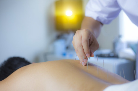 Acupuncture For Diabetes Confirmed | Daily realities of diabetic patients | Scoop.it