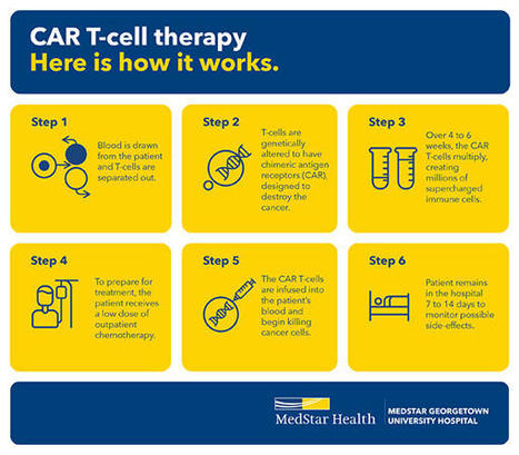 CAR T-cell therapy | Tailored Expertise Sourcin...