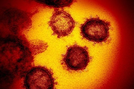 Coronavirus: What are the symptoms of Covid-19? | Covid Report | Scoop.it