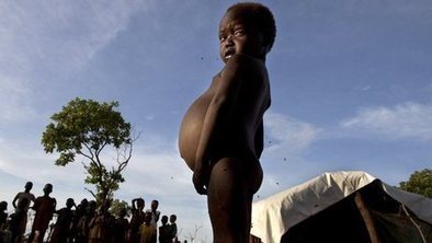 Does a child die of hunger every 10 seconds? | SSSC Politics  Development | Scoop.it