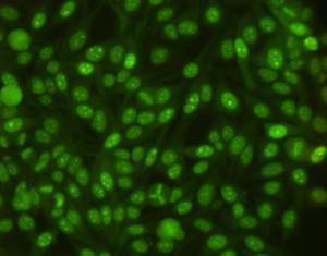 Informes Diagnósticos en Patologías Autoinmunes - Formación GECLID -5ª edición-créditos CfC | Immunology Diagnosis | Scoop.it