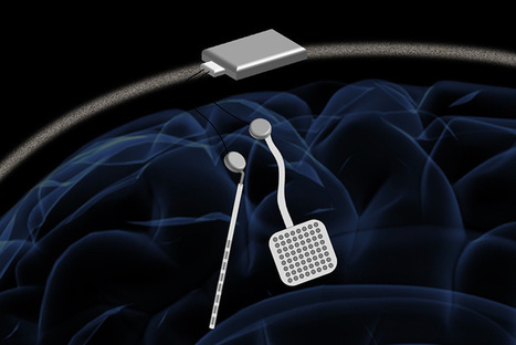 Wireless &lsquo;pacemaker for the brain&rsquo; could be new standard treatment for neurological disorders | I didn't know it was impossible.. and I did it :-) - No sabia que era imposible.. y lo hice :-) | Scoop.it